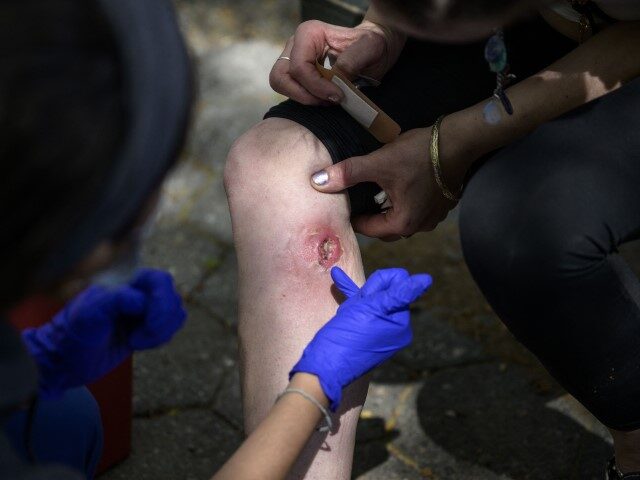 Registered nurse Jazmyna Fanini cleans the wound of drug user Crystal Mojica in a park in New York City on April 24, 2023. The tranquillizer, approved for veterinary use by the US Food and Drug Administration (FDA), has infiltrated the illegal drugs market in the US, with producers increasingly using …